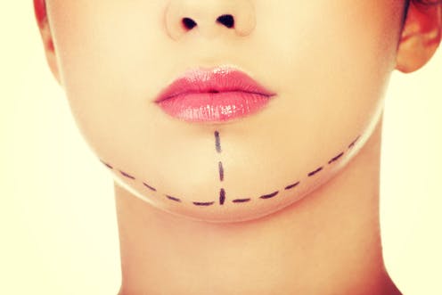 raised acne scar treatment