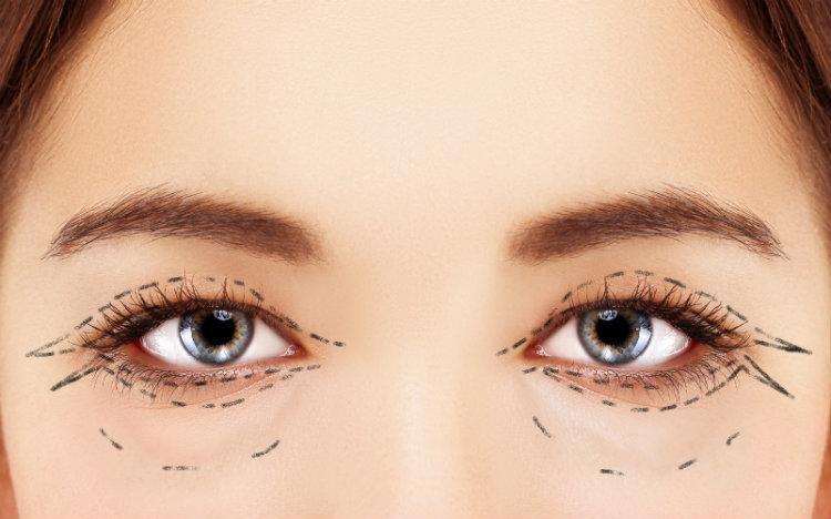 raised acne scar treatment
